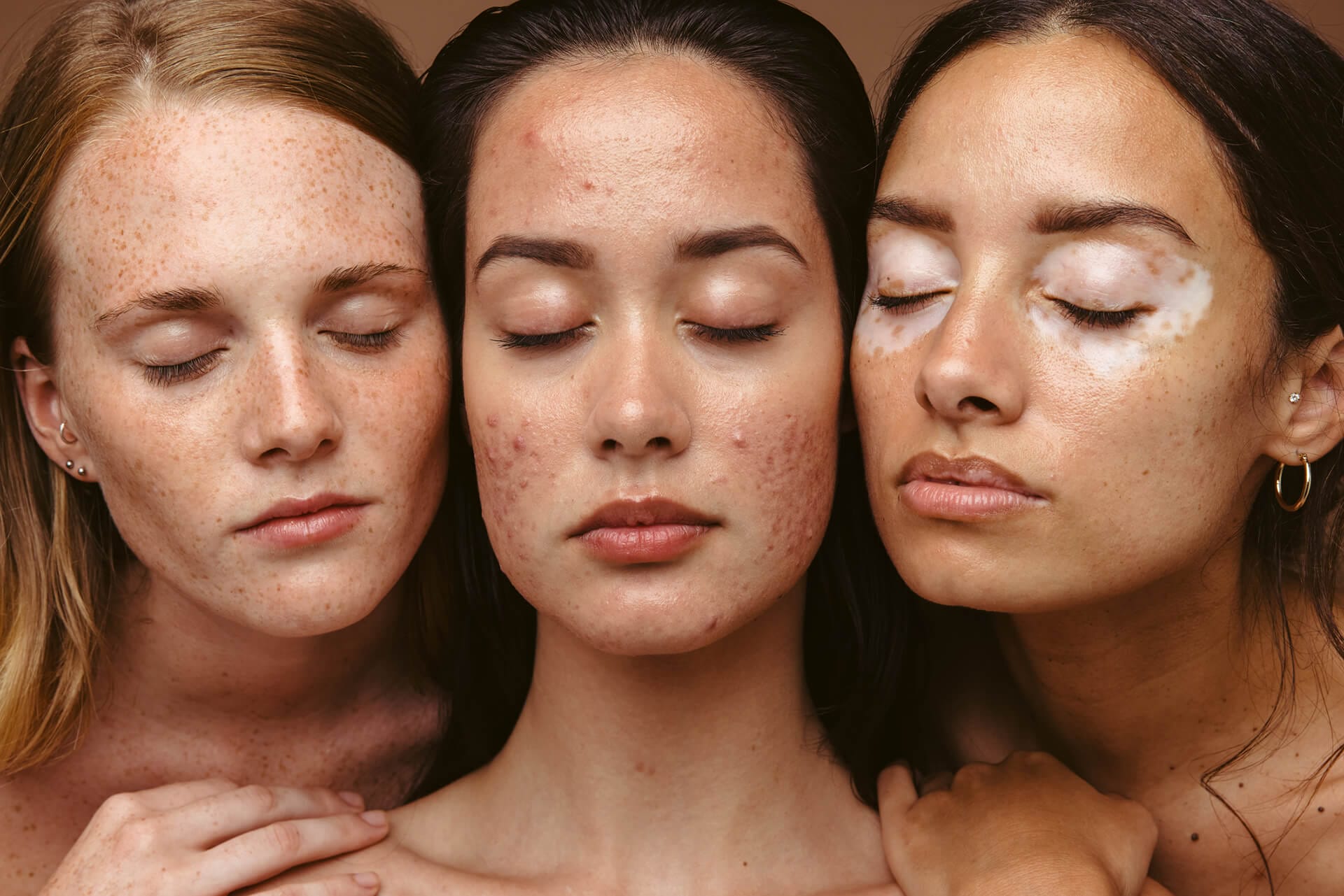 Skin Conditions & Concerns